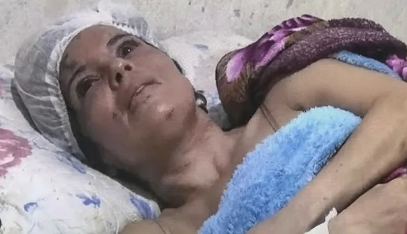Mulher Sobrevive Após Ser Enterrada Viva em Tentativa de Feminicídio em Itabuna